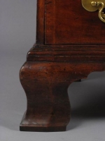Tad Fallon leg after repair